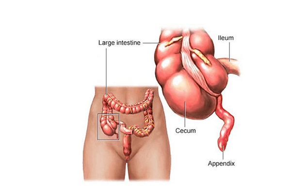 Appendix