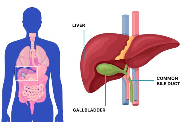 Gallbladder Removal Surgery